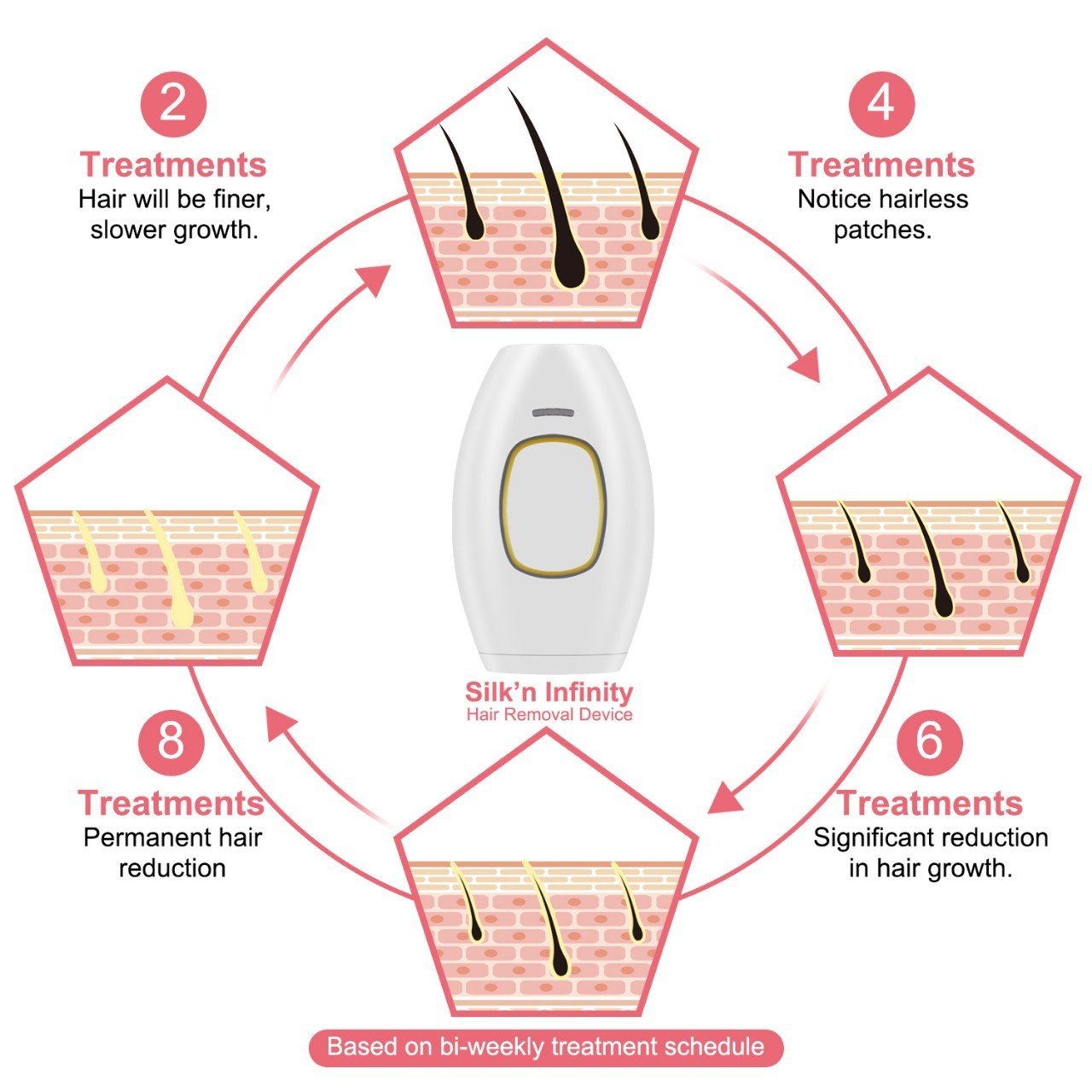 SkinGlow IPL Device